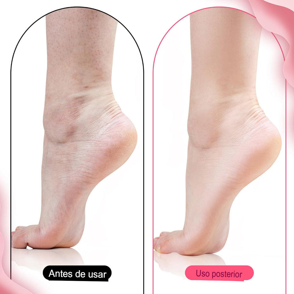 Combo Pies Suaves — Stick Urea 60% + Calcetín de Silicona | Resultados en 7 días